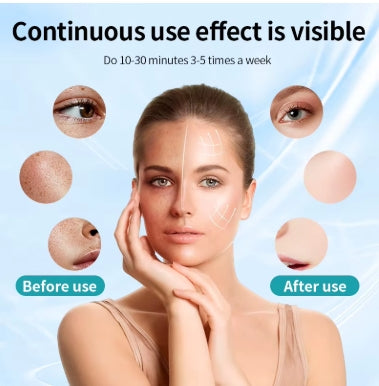 LED Light Therapy Face & Neck Mask – Photon Skin Rejuvenation Device
