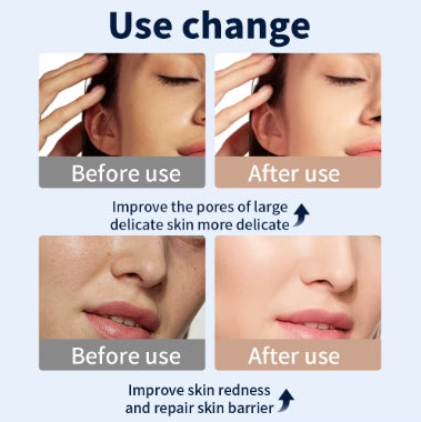 LED Light Therapy Face & Neck Mask – Photon Skin Rejuvenation Device